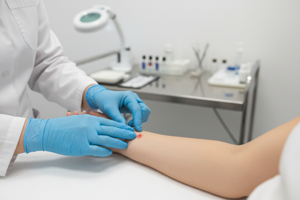What to use instead of latex exam gloves when your hands react