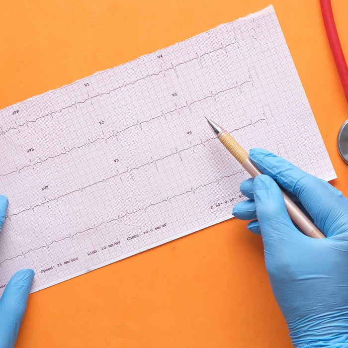 Hands donned with blue medical gloves above an ECG printout graph beside a pill box and a stethoscope.
